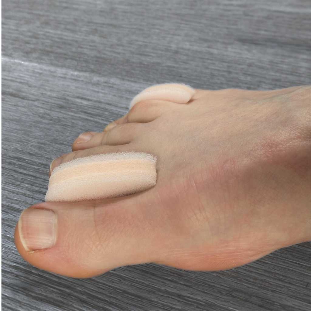 3 - layer foam toe spacers - DrGaffneyBestFoot
