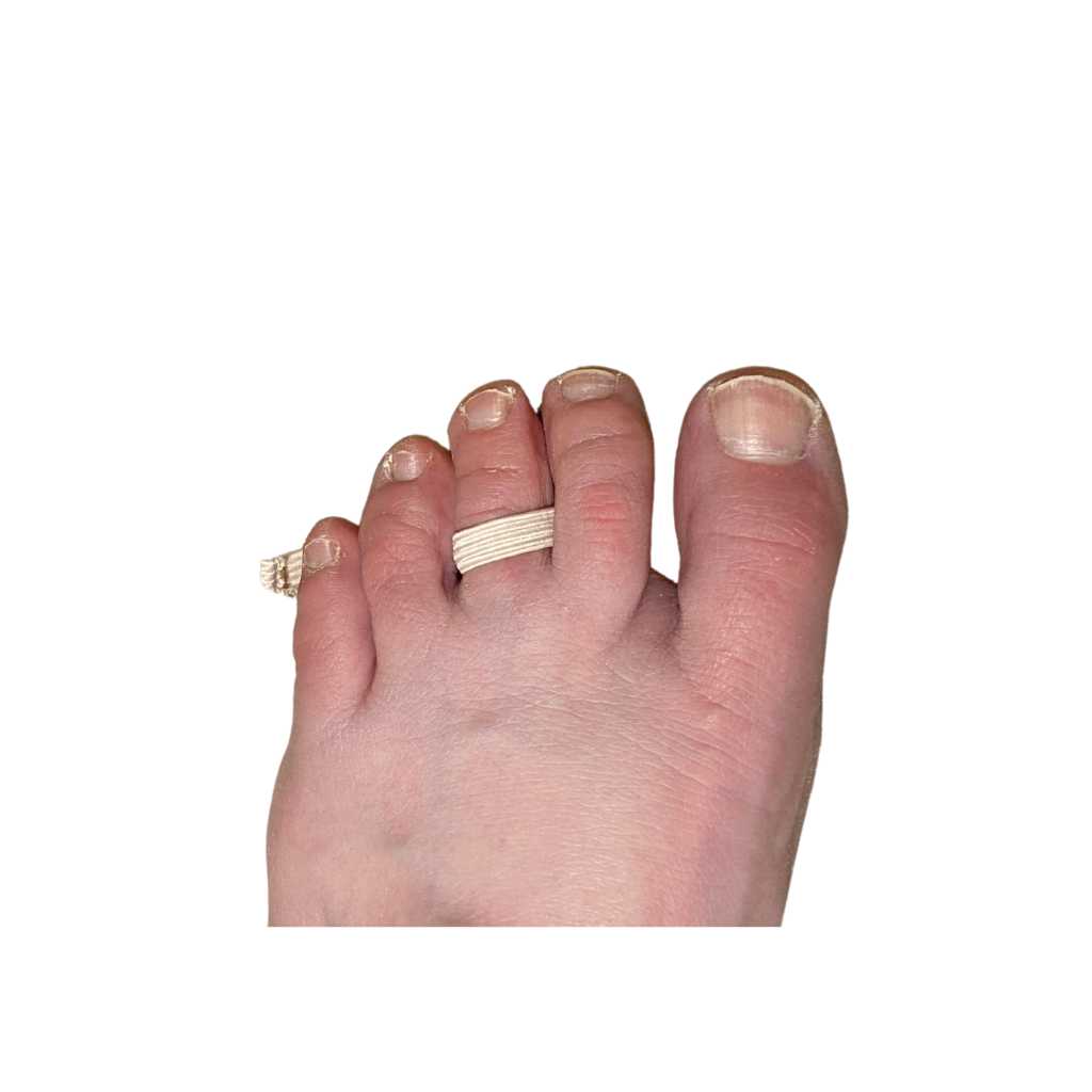 hammer toe splint suede fabric from top of foot