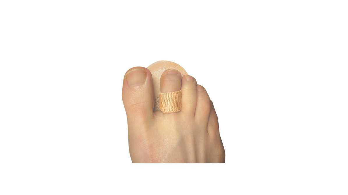 Toe Straightener- single toe (Budin Toe Splint)