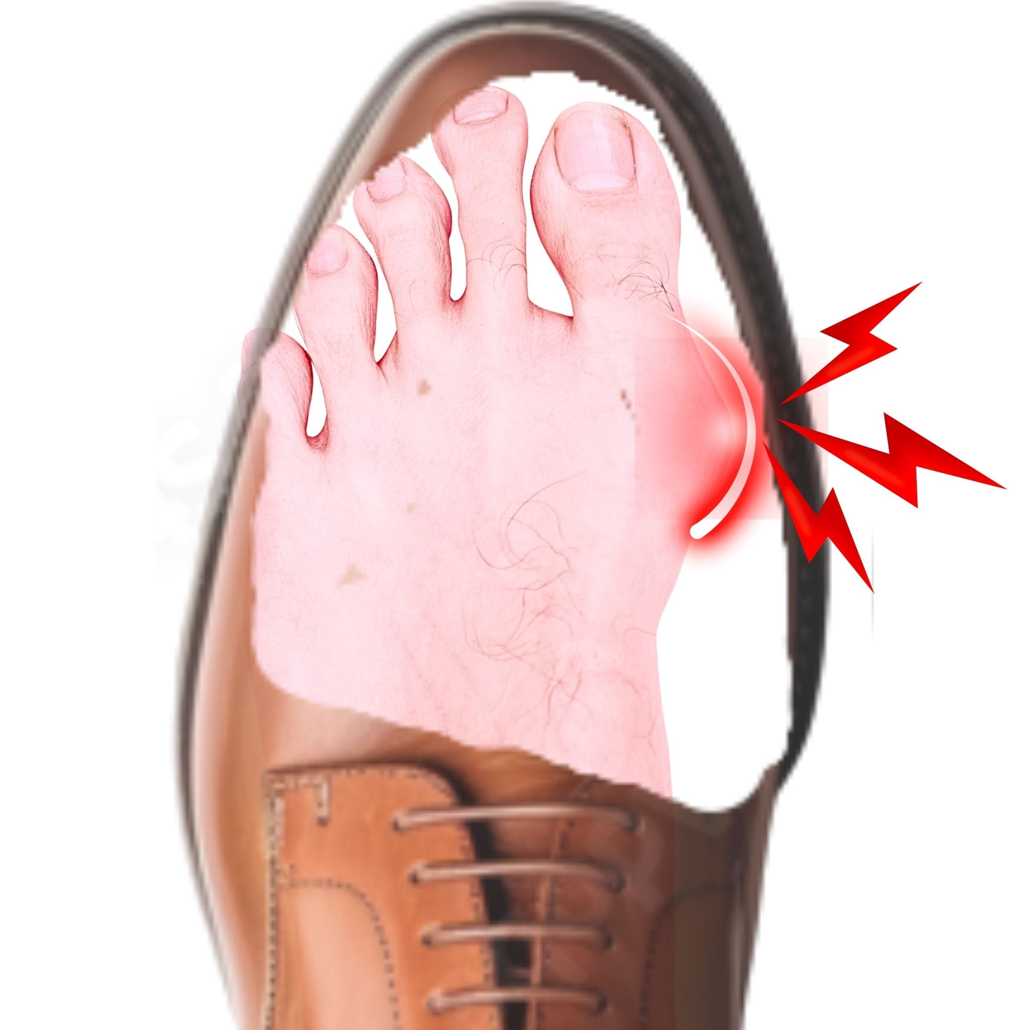 shoe cut out showing  foot with bunion with  red jagged lines inside 