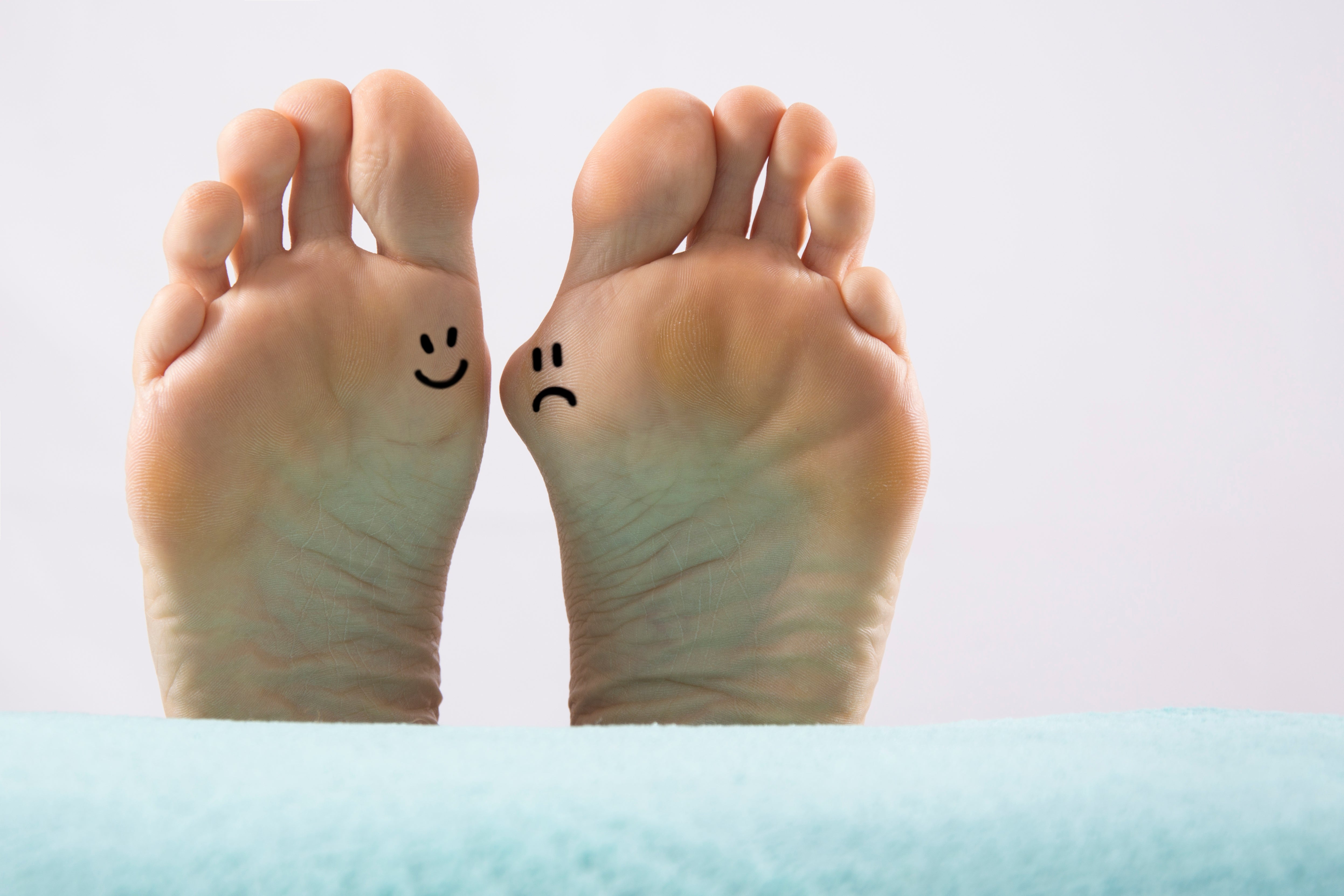 feet with happy and sad face on bunion