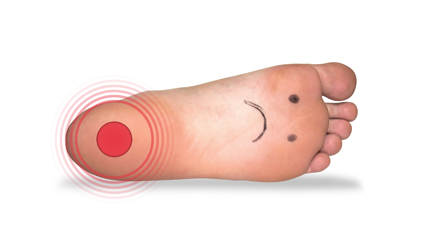 foot laying on side with sad face on the ball and red mark on heel