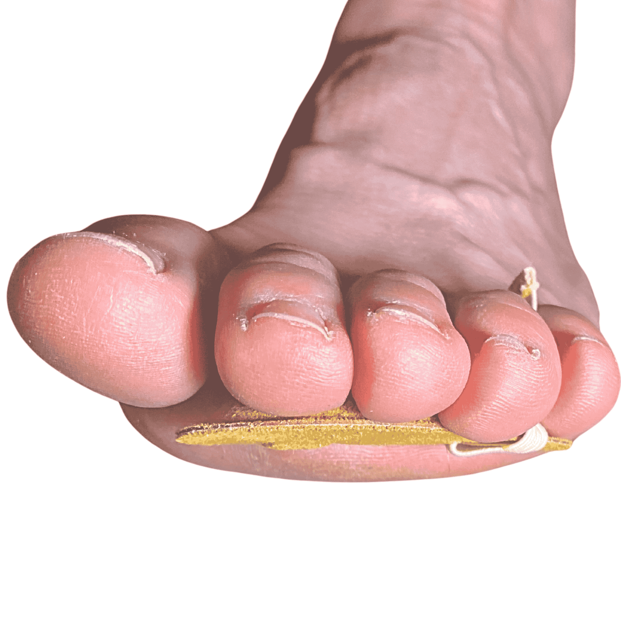 Toe Tip Relief
