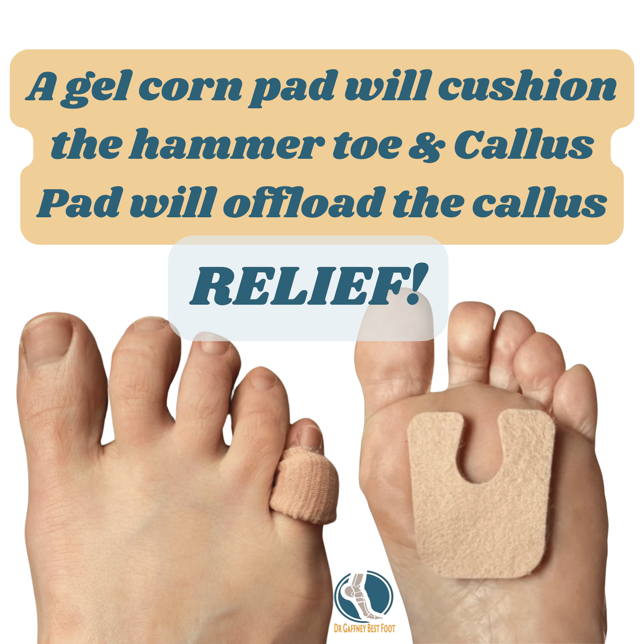 Gel corn pad and callus pad on a foot with text about relief.