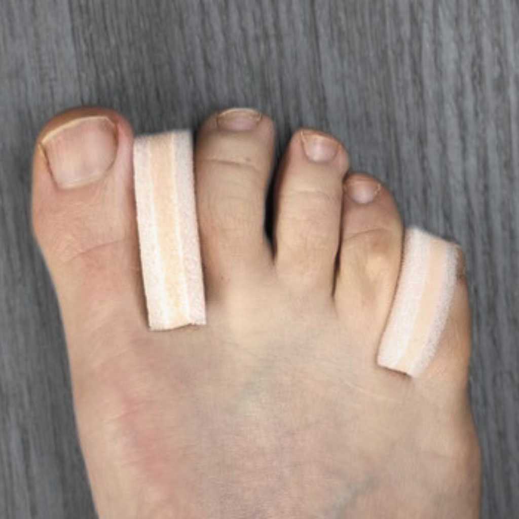 3 - layer foam toe spacers - DrGaffneyBestFoot