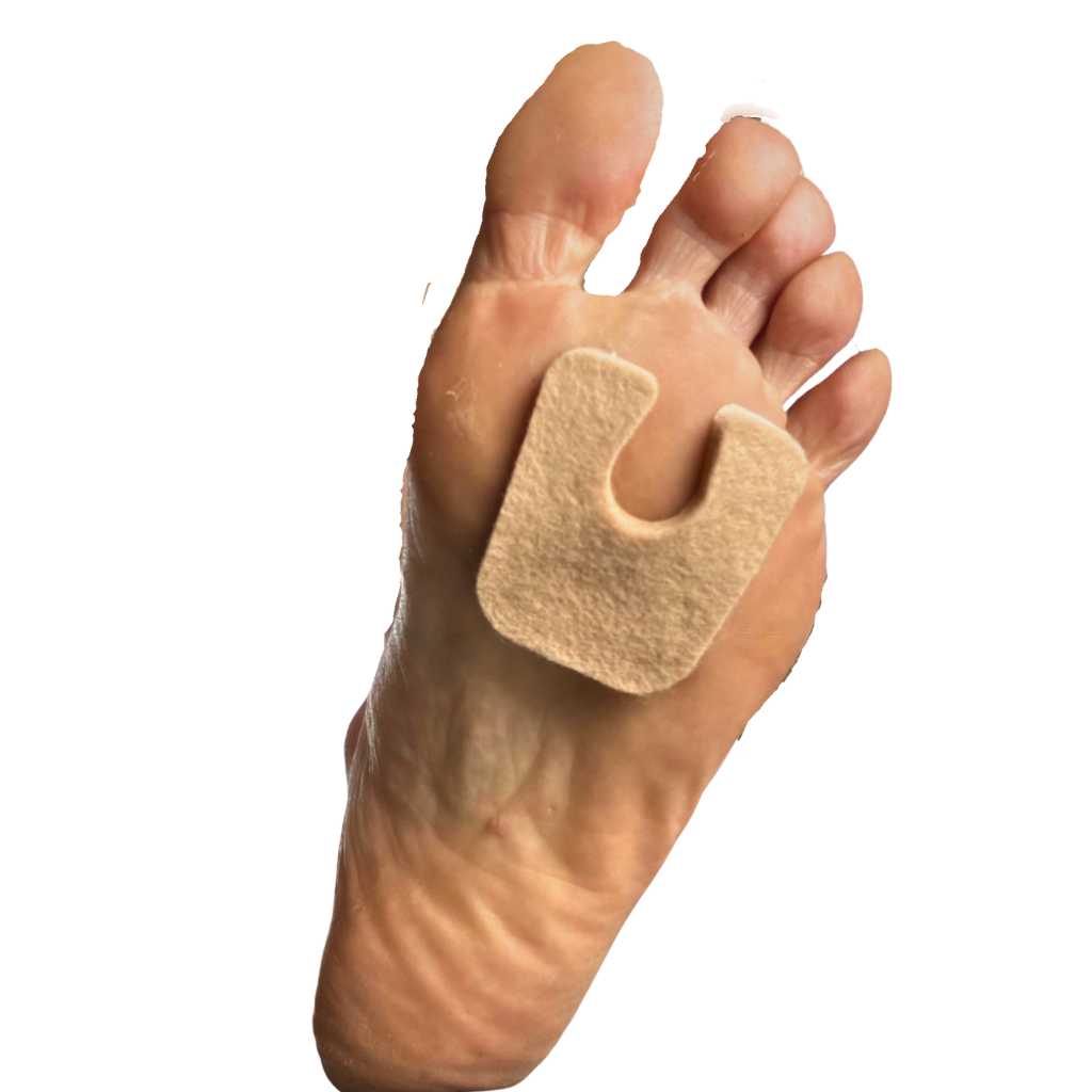 Adhesive felt callus protector on a foot against a white background