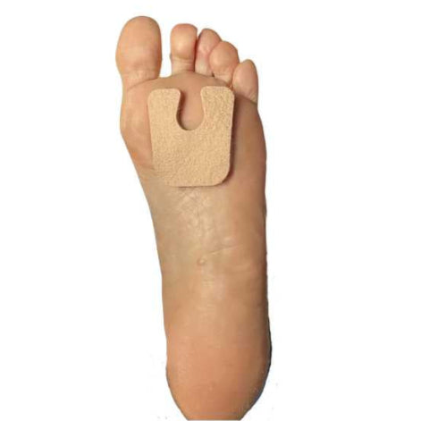 Callus Protector