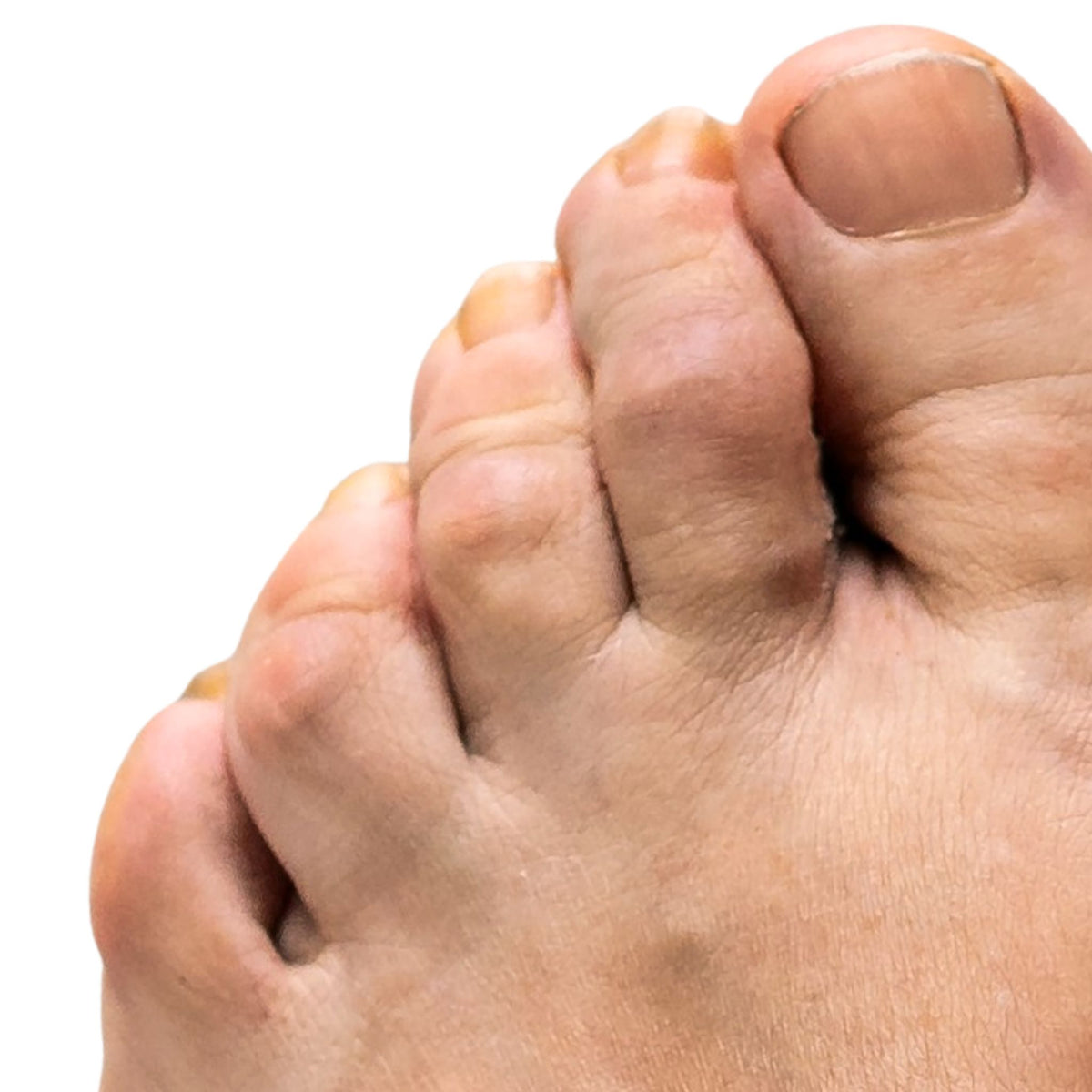 Close-up of a foot with a focus on the toes against a white background
