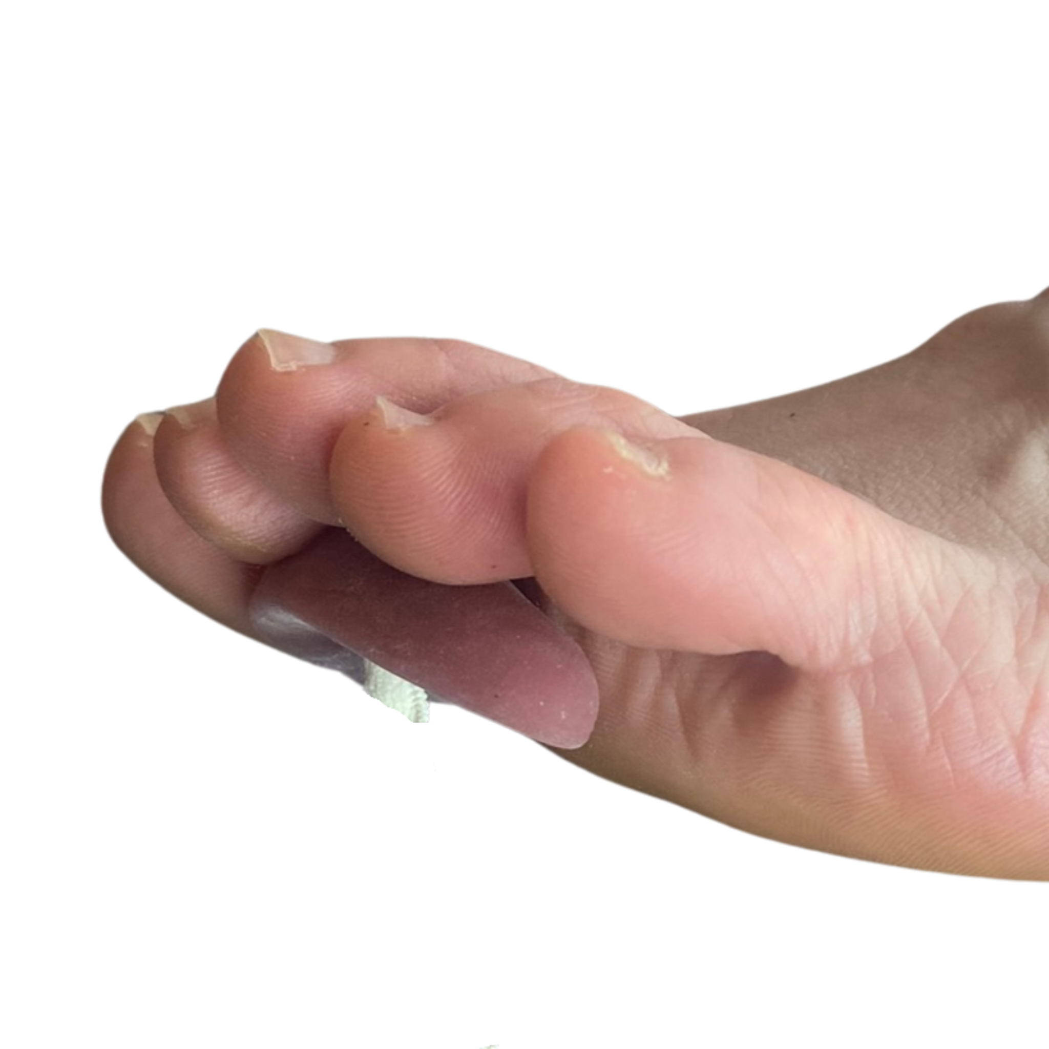 Hammer Toe Splint- adjustable gel crest pad