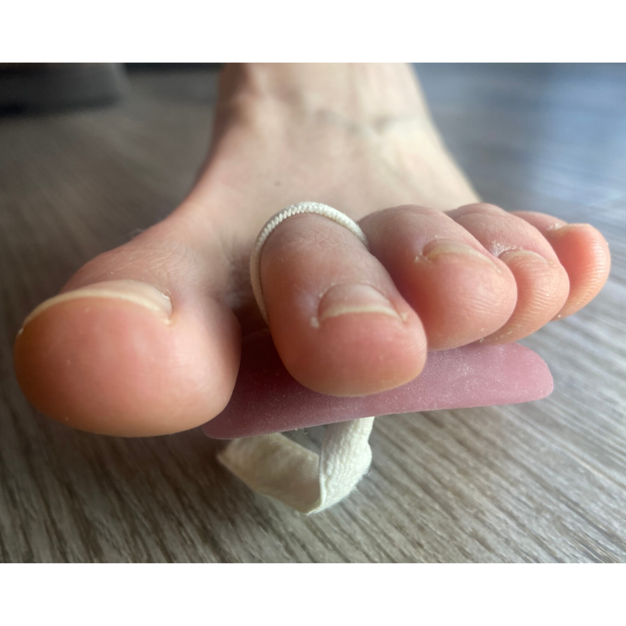 Hammer Toe Splint- adjustable gel crest pad