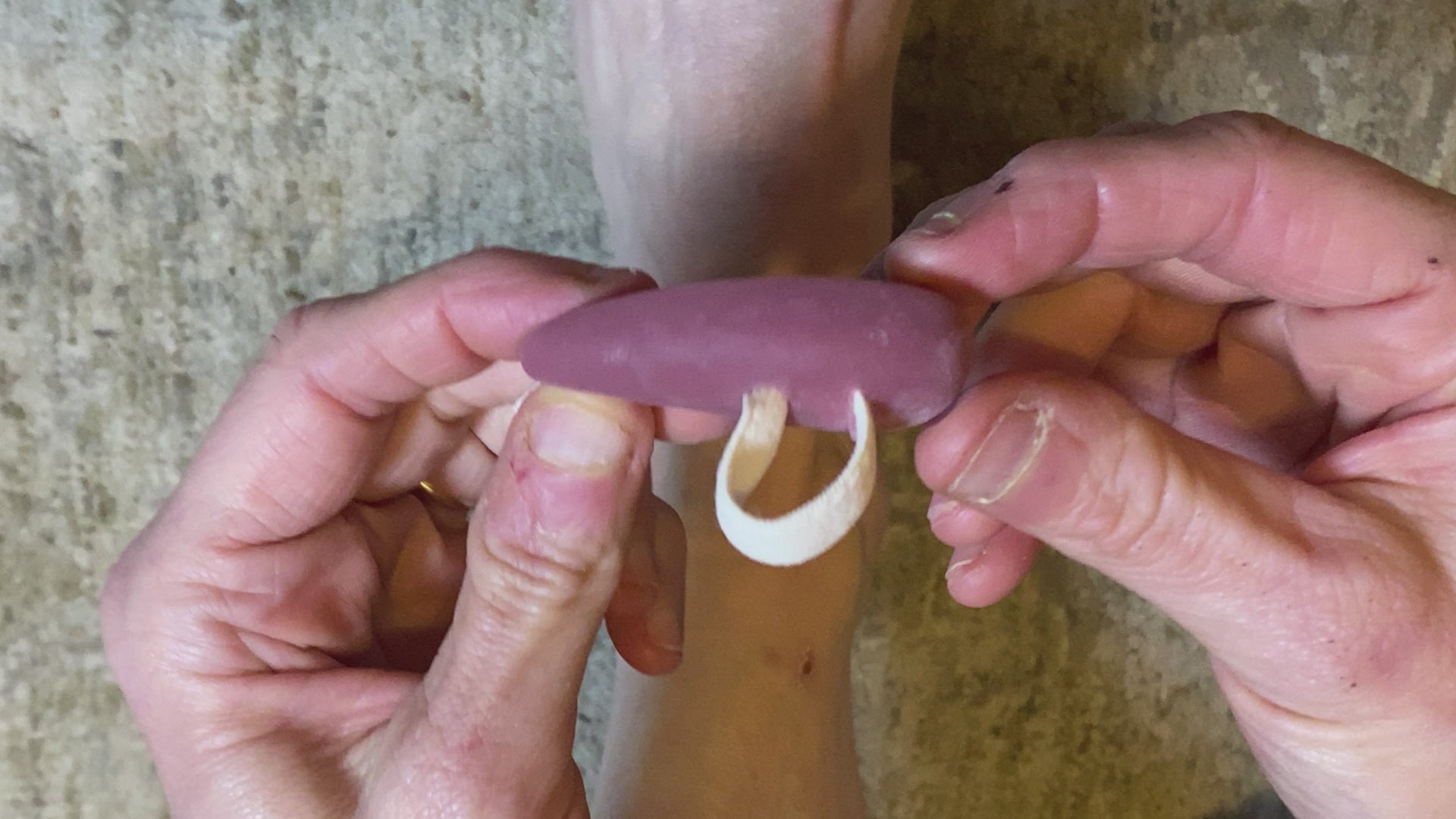 Adjustable Hammer Toe Splint