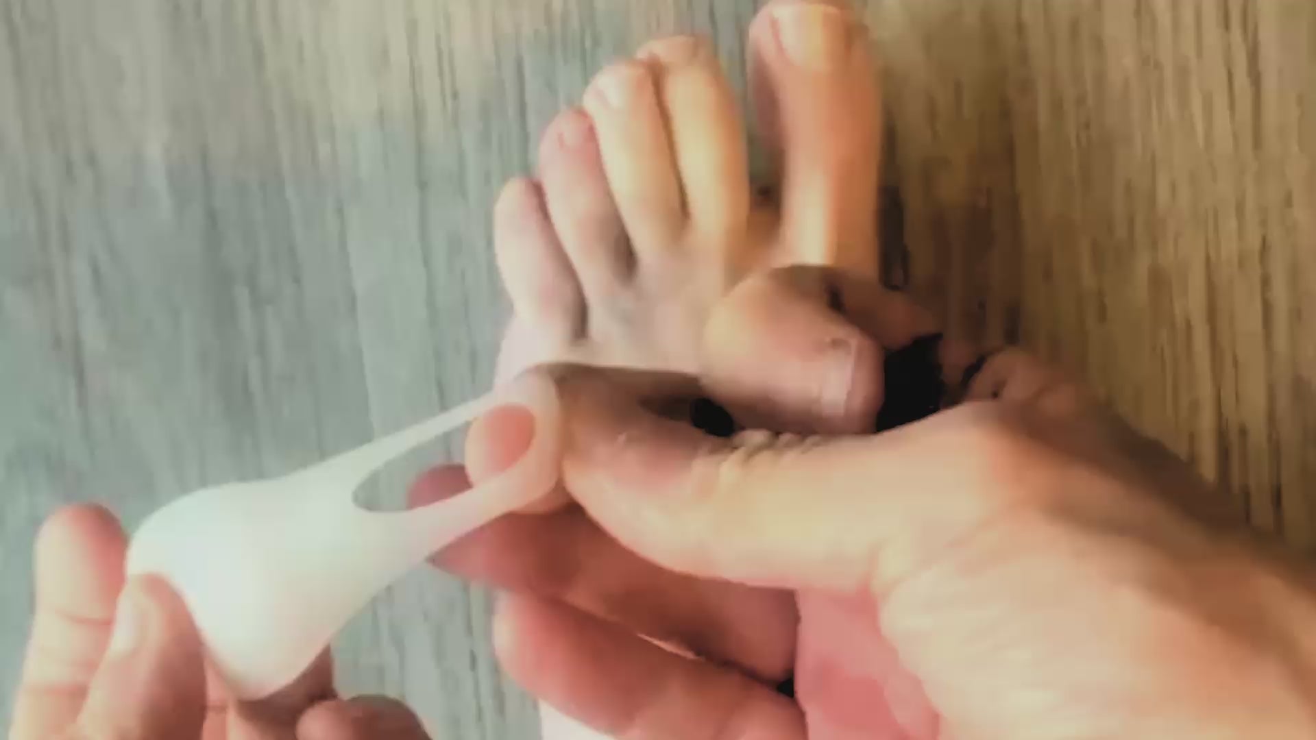 video of  bunionette gel guard/pad being applied to foot