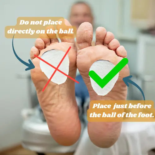Metatarsal Pads (adhesive felt) for Ball of the Foot Relief