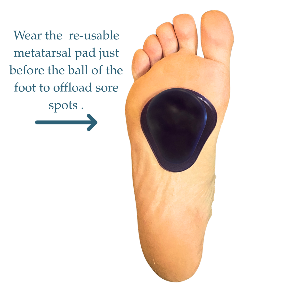 A close-up of a human foot with a dark blue re-usable metatarsal pad applied to the sole, alongside text instructions on how to use it for offloading sore spots.