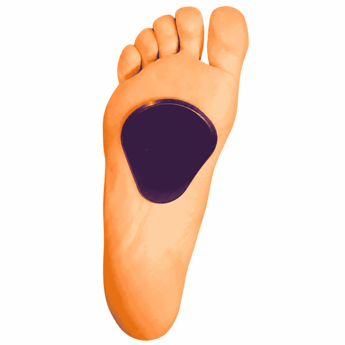 A human foot  with a dark purple metatarsal adhesive pad applied to the arch area, isolated on a white background.